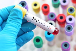 Gejala dan Penangan Tepat HIV & AIDS Yang Harus Kalian Ketahui