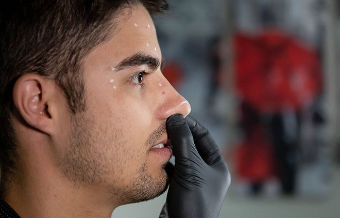 Benarkah Mencuci Hidung Bisa Cegah Sinusitis?