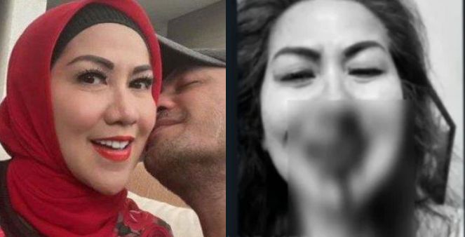 Kronologi Venna Melinda Keluar Kamar Hortel Berteriak Dengan Hidung Berdarah
