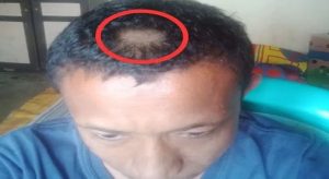 Kronologi Orang Tua Siswa Potong Rambut Sang Guru