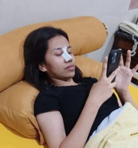 Natizen Kembali Menyoroti Mayang Seusai Oprasi Hidung, Tetap Cantikan Fuji