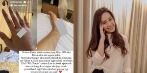 Lady Nayoan Perlihatkan Luka di Tangan dan Kaki Akibat Kecelakaan Mobil Bersama Rendy Kjaernett