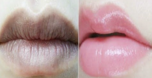 8 Tips Jaga Bibir agar Tidak Menghitam