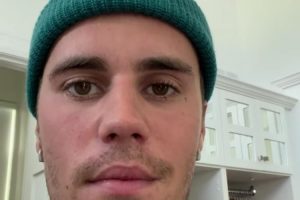 Wajah Justin Bieber Lumpuh Sebagian