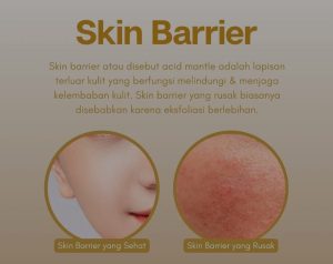 Inilah penjelasan dari Skin Barrier