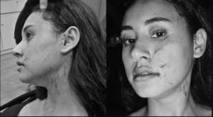 Perseteruan Selebgram Afifah Riyad dan Regi Nazlah Mencapai Puncak, Suami Afifah Juga Laporkan Regi Nazlah