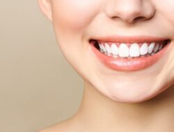 Tips Jaga Kesehatan Gigi secara Efektif untuk Mencegah Gigi Menguning