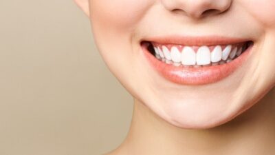 Senyuman cerah serta gigi putih bersih bukan hanya terlihat indah secara estetika, tetapi juga mencerminkan kesehatan gigi yang baik. Gigi yang menguning dapat menjadi (Sumber foto: Alodokter)