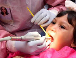 8Cara Sederhana Menghilangkan Karang Gigi pada Anak