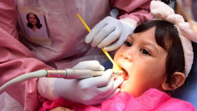 Cara meghilangkan karang gigi anak (Sumber Foto. audydental.com)