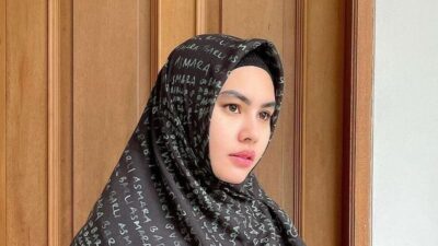 Kartika Putri Mengalami Stevens-Johnson Syndrome: Pesan Inspiratif untuk Para Wanita