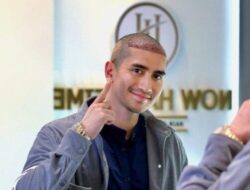 Verrell Bramasta Jalani Transplantasi Rambut di Turki, Ikuti Jejak Atta Halilintar dan Anang Hermansyah