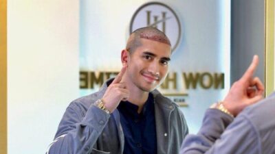 Verrell Bramasta Jalani Transplantasi Rambut di Turki, Ikuti Jejak Atta Halilintar dan Anang Hermansyah